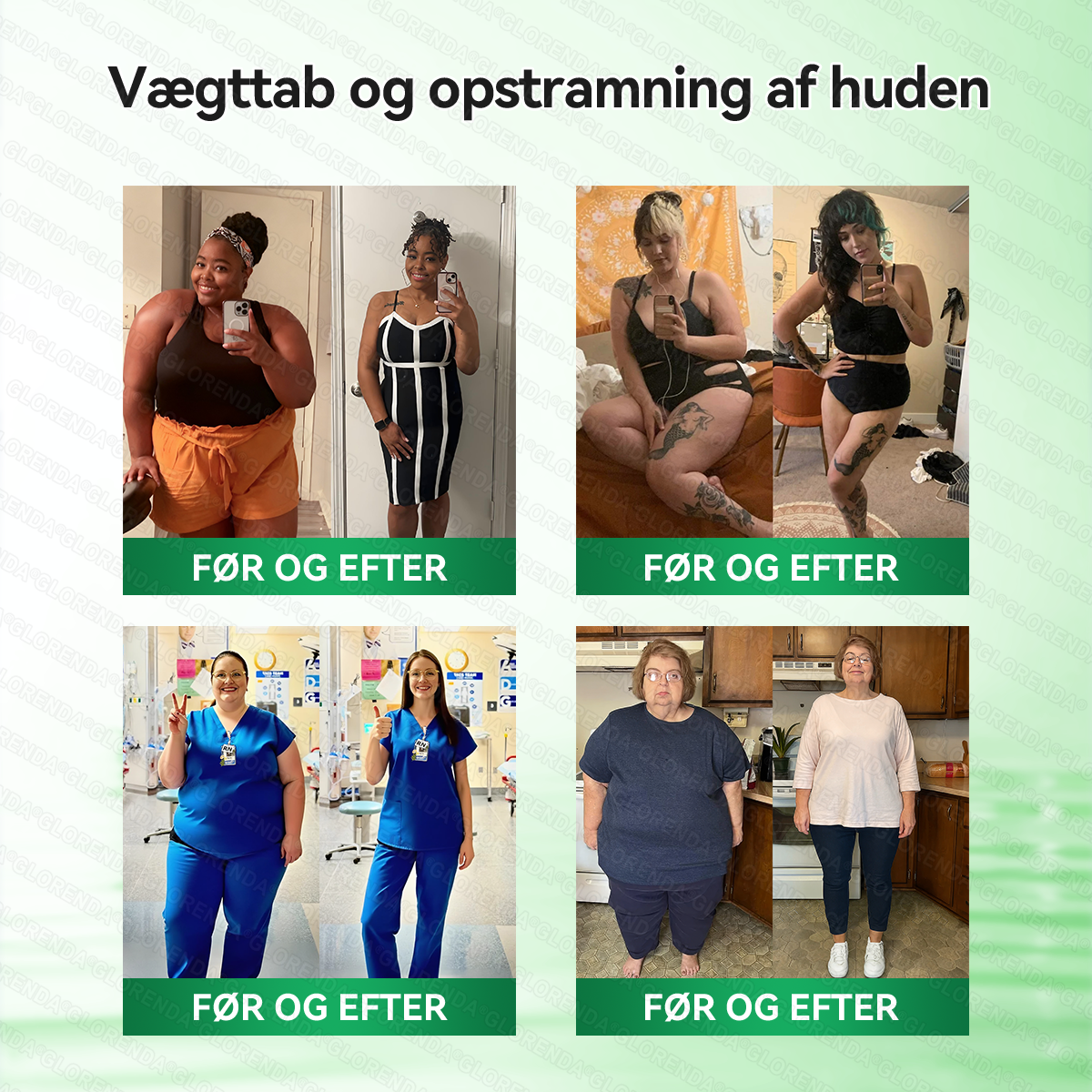 𝑶𝒇𝒇𝒊𝒄𝒊𝒆𝒍 𝑩𝒖𝒕𝒊𝒌 |  👍👍𝐆𝐋𝐎𝑹𝑬𝑵𝐃𝗔® 𝑴𝒐𝒓𝒊𝒏𝒈𝗮 · 𝗕𝗲𝗿𝗯𝗲𝗿𝗶𝗻 × 𝑵𝐀𝐃⁺ 𝟏𝟎-𝐢-𝟏 𝗔𝗱𝘃𝗮𝗻𝗰𝗲𝗿𝗲𝘁 𝙉𝙖𝙣𝙤-𝙈𝙞𝙠𝙧𝙤𝙣𝙖̊𝙡 𝙋𝙡𝙖𝙨𝙩𝙚𝙧 🇩🇰 (Kun én gang om dagen – synlige forandringer på 7 dage)